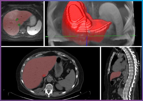 Deutscher Lebertag Deutscher Lebertag