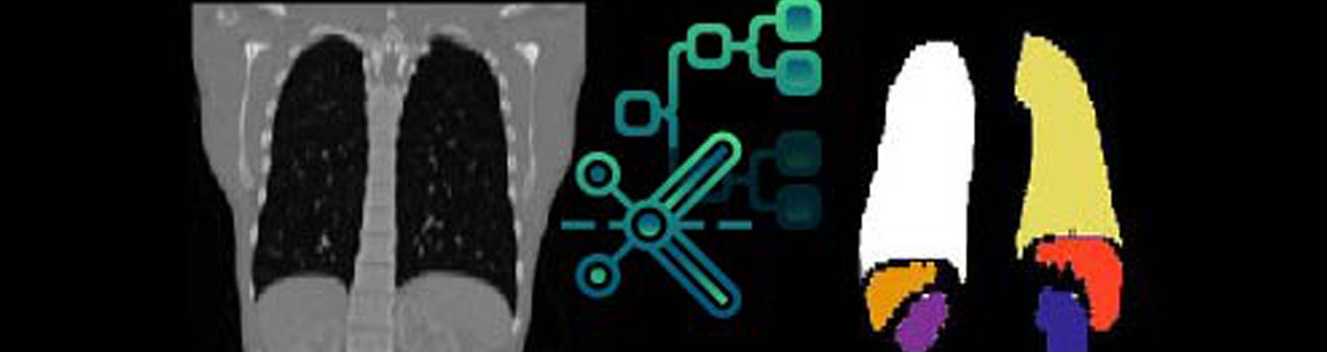 DNN Compression DNN Compression