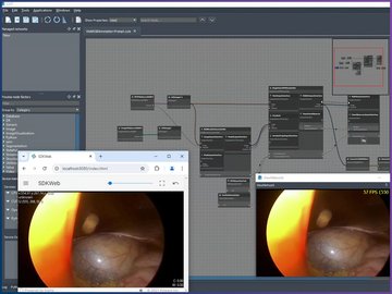 Semi-supervised pixel annotation in surgical endoscopic videos based on DNNs