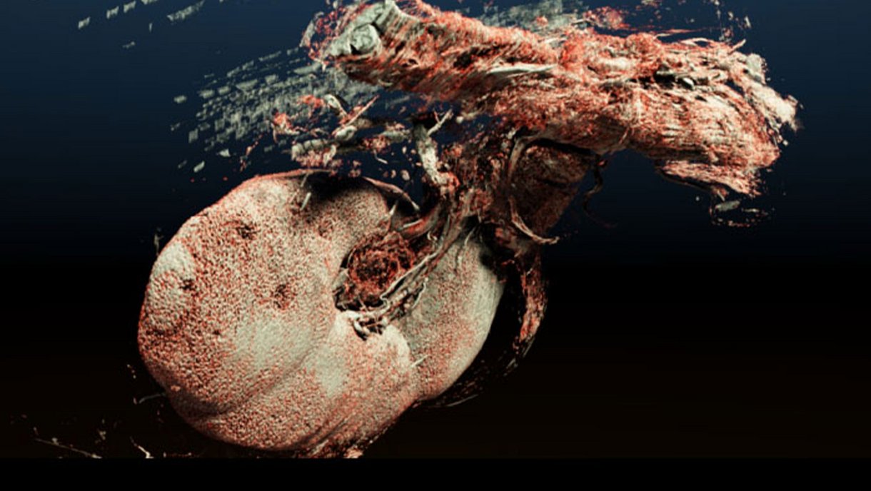 3D-Rekonstruktion aus histologischen Objektträgeraufnahmen