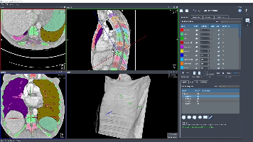 Automated segmentation and measurement of anatomical structures of spine and thorax