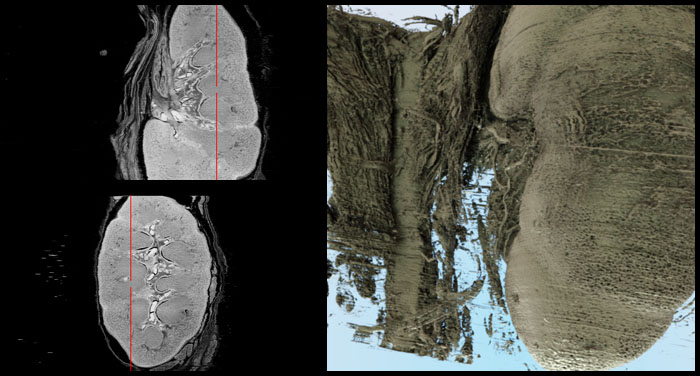 Visualisierungen der Nierenschnitte als Ergebnis der HiD 3D-Rekonstruktion