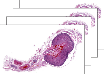 Histologische Schnitte aus einem fötalen Nierendatensatz